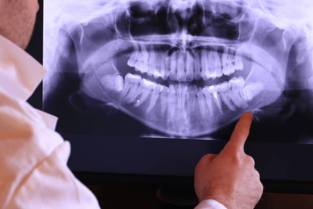 Best Emergency Denture Repair in Reed Creek, GA